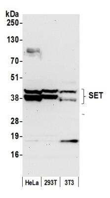 Western Blot: SET Antibody [NBP1-26646] - Detection of Human and Mouse SET by Western Blot. Samples: Whole cell lysate (50 ug) from HeLa, 293T, and mouse NIH3T3 cells prepared using NETN lysis buffer. Antibody: Affinity purified rabbit anti-SET antibody NBP1-26646 used for WB at 0.1 ug/ml. Detection: Chemiluminescence with an exposure time of 30 seconds.