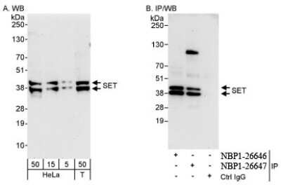 Western Blot: SET Antibody [NBP1-26647] - Whole cell lysate from HeLa and 293T cells. SET was also immunoprecipitated by rabbit anti-SET antibody NBP1-26646.