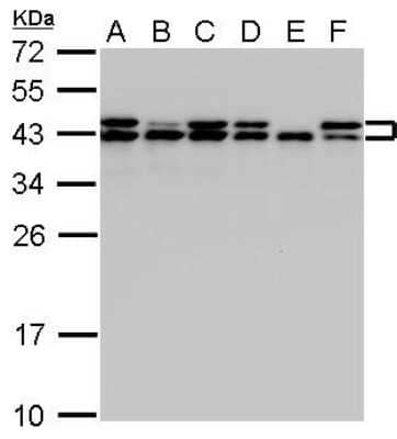 Western Blot: SET Antibody [NBP1-33713] -  SET antibody detects SET protein by Western blot analysis. A. 30 ug A431 whole cell lysate/extract whole cell lysate/extract. B. 30 ug H1299 whole cell lysate/extract. C. 30 ug HeLa whole cell lysate/extract. D. 30 ug HepG2 whole cell lysate/extract. E. 30 ug Molt-4 whole cell lysate/extract. F. 30 ug Raji whole cell lysate/extract. 12 % SDS-PAGE. SET antibody dilution: 1:1000 SET antibody detects SET protein by Western blot analysis.Observed SET protein is larger than the predicted M.W., possibly due to post-translational