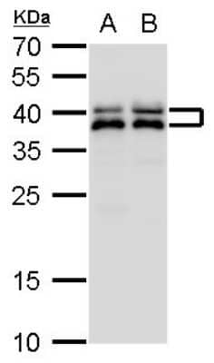 Western Blot: SET Antibody [NBP1-33713] -  SET antibody detects SET protein by western blot analysis. A. 30 ug PC-12 whole cell lysate/extract. B. 30 ug Rat2 whole cell lysate/extract. 12 % SDS-PAGE. SET antibody dilution: 1:1000.