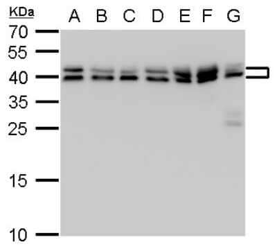 Western Blot: SET Antibody [NBP1-33713] - SET antibody detects SET protein by western blot analysis. A. 30 ug Neuro2A whole cell lysate/extract. B. 30 ug GL261 whole cell lysate/extract. C. 30 ug C8D30 whole cell lysate/extract. D. 30 ug NIH-3T3 whole cell lysate/extract. E. 30 ug BCL-1 whole cell lysate/extract. F. 30 ug Raw 264.7 whole cell lysate/extract. G. 30 ug C2Cl2 whole cell lysate/extract. 12 % SDS-PAGE. SET antibody dilution: 1:1000