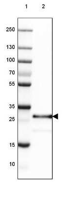 Western Blot: SET Antibody [NBP2-38031] - Lane 1: Marker [kDa] 250, 130, 100, 70, 55, 35, 25, 15, 10Lane 2: Human Liver tissue