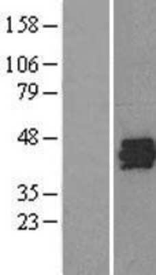 Western Blot: SET Overexpression Lysate (Adult Normal) [NBL1-15867] Left-Empty vector transfected control cell lysate (HEK293 cell lysate); Right -Over-expression Lysate for SET.