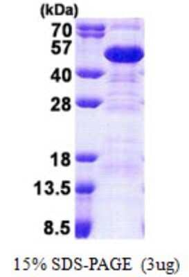 SDS-Page: Recombinant Human SET Protein [NBP2-23464]