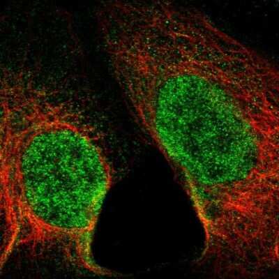 Immunocytochemistry/Immunofluorescence: SET1B Antibody [NBP1-87896] - Staining of human cell line A-431 shows localization to nucleoplasm.