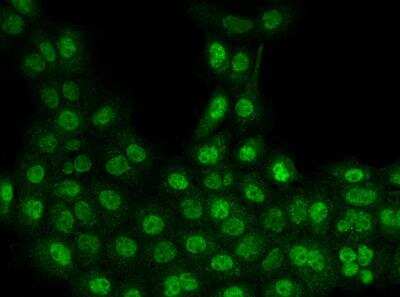 Immunocytochemistry/Immunofluorescence: SET1B Antibody [NBP3-06532] - Staining of SETD1B in A431 cells. Cells were fixed with 4% PFA, permeabilzed with 0.3% Triton X-100 in PBS,blocked with 10% serum, and incubated with rabbit anti-Human SETD1B polyclonal antibody (dilution ratio 1:200) at 4? overnight. Then cells were stained with the Alexa Fluor®488-conjugated Goat Anti-rabbit IgG secondary antibody (green). Positive staining was localized to Nucleus.