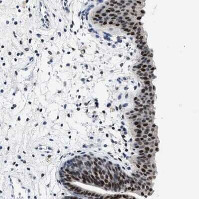 Immunohistochemistry-Paraffin: SET1B Antibody [NBP1-87896] - Staining of human urinary bladder shows strong nuclear positivity.