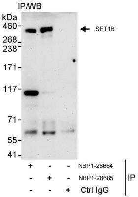 Immunoprecipitation: SET1B Antibody [NBP1-28685] - Samples: Whole cell lysate (1 mg for IP, 20% of IP loaded) from HeLa cells.   Antibodies: Affinity purified rabbit anti-SET1B antibody NBP1-28685 used for IP at 10 ug/mg lysate.  SET1B was also immunoprecipitated by rabbit anti-SET1B antibody NBP1-28684, which recognizes an upstream epitope.  For blotting immunoprecipitated SET1B, NBP1-28684 was used at 1 ug/ml.  Detection: Chemiluminescence with an exposure time of 3 minutes.