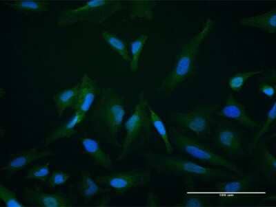 Immunocytochemistry/Immunofluorescence: SETBP1 Antibody [H00026040-B01P] - Analysis of purified antibody to SETBP1 on HeLa cell. (antibody concentration 10 ug/ml)