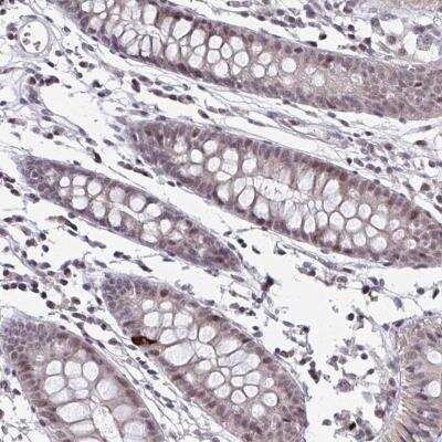 Immunohistochemistry-Paraffin: SETBP1 Antibody [NBP2-31667] - Staining of human colon shows nuclear positivity in glandular cells.