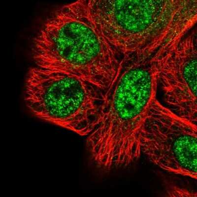 Immunocytochemistry/Immunofluorescence: SETD1A Antibody [NBP1-81513] - Immunofluorescent staining of human cell line A-431 shows localization to nuclear speckles.
