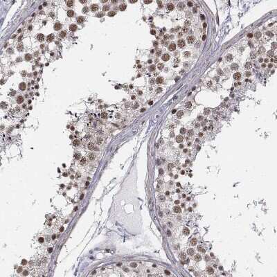 Immunohistochemistry-Paraffin: SETD1A Antibody [NBP1-81513] - Staining of human testis shows high expression.