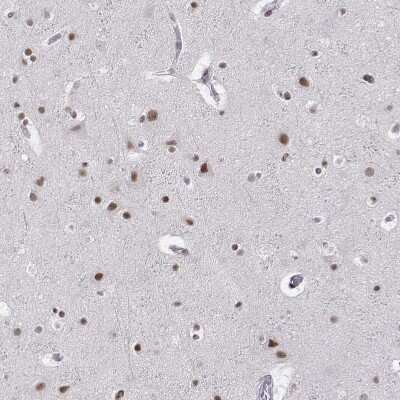 Immunohistochemistry-Paraffin: SETD1A Antibody [NBP1-81513] - Staining of human Cerebral cortex shows moderate nuclear positivity in neuronal and glial cells.