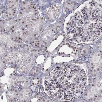Immunohistochemistry-Paraffin: SETD1A Antibody [NBP1-81513] - Staining of human Kidney shows moderate nuclear positivity in cells in tubules and glomeruli.