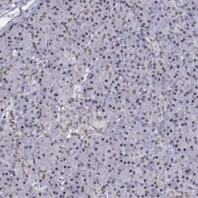 Immunohistochemistry-Paraffin: SETD1A Antibody [NBP1-81513] - Staining of human Pancreas shows moderate nuclear positivity in exocrine glandular cells.