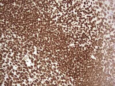 Immunohistochemistry: SETD1A Antibody (OTI7B7) - Azide and BSA Free [NBP2-74144] - Analysis of Human tonsil tissue. (Heat-induced epitope retrieval by 1 mM EDTA in 10mM Tris, pH8.5, 120C for 3min)