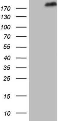 Western Blot: SETD1A Antibody (OTI7B7) - Azide and BSA Free [NBP2-74144] - Analysis of HEK293T cells were transfected with the pCMV6-ENTRY control (Left lane) or pCMV6-ENTRY SETD1A.