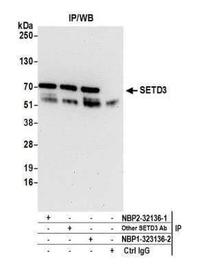 Immunoprecipitation: SETD3 Antibody [NBP2-32136] - Detection of human SETD3 by western blot of immunoprecipitates. Samples: Whole cell lysate (1.0 mg per IP reaction; 20% of IP loaded) from Jurkat cells. Antibodies: Affinity purified rabbit anti-SETD3 antibody NBP2-32136 (lot NBP2-32136-2) used for IP at 3 ug per reaction. SETD3 was also immunoprecipitated by a previous lot of this antibody (lot NBP2-32136-1) and another rabbit anti-SETD3 antibody. For blotting immunoprecipitated SETD3, NBP2-32136 was used at 0.4 ug/ml. Detection: Chemiluminescence with an exposure time of 30 seconds.