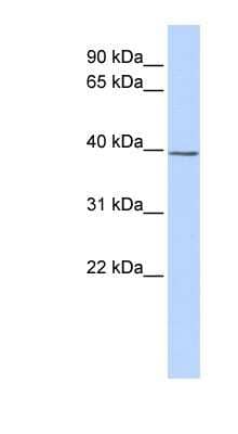 Western Blot: SETD3 Antibody [NBP1-79446] - Jurkat cell lysate, concentration 0.2-1 ug/ml.