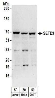 Western Blot: SETD3 Antibody [NBP2-32137] - Samples:  Whole cell lysate (50 ug) from Jurkat, HeLa, and 293T cells. Antibodies:  Affinity purified rabbit anti-SETD3 antibody NBP2-32137 used for WB at 0.1 ug/ml.  Detection: Chemiluminescence with an exposure time of 30 seconds.
