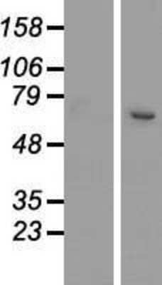 Western Blot: SETD3 Overexpression Lysate (Adult Normal) [NBP2-06055] Left-Empty vector transfected control cell lysate (HEK293 cell lysate); Right -Over-expression Lysate for SETD3.