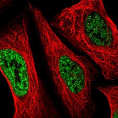 Immunocytochemistry/Immunofluorescence: SETD4 Antibody [NBP2-55595] - Staining of human cell line U-2 OS shows localization to nuclear speckles.