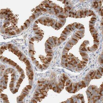 Immunohistochemistry-Paraffin: SETD4 Antibody [NBP1-88279] - Staining of human fallopian tube shows moderate cytoplasmic and nuclear positivity in glandular cells.