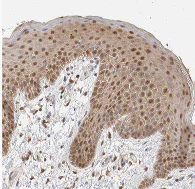 Immunohistochemistry-Paraffin: SETD4 Antibody [NBP1-88279] - Staining of human skin shows weak cytoplasmic positivity and moderate nuclear positivity in squamous epithelial cells.