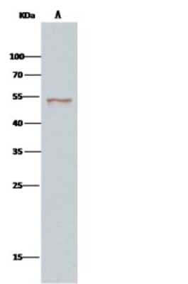 Immunoprecipitation: SETD7/9 Antibody [NBP2-99744] - SETD7/9 was immunoprecipitated using: Lane A: 0.5 mg Jurkat Whole Cell Lysate. 2 ul anti-SETD7/9 rabbit polyclonal antibody and 15 ul of 50 % Protein G agarose. Primary antibody: Anti-SETD7/9 rabbit polyclonal antibody, at 1:200 dilution. Secondary antibody: Clean-Bloto IP Detection Reagent (HRP) at 1:500 dilution. Developed using the DAB staining technique. Performed under reducing conditions. Predicted band size: 41 kDa. Observed band size: 52 kDa