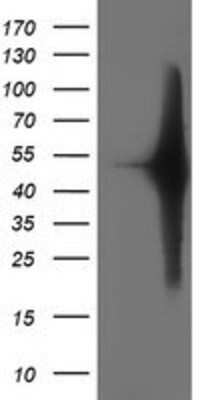 Western Blot: SETD7 Antibody (2D10) [NBP2-01066] - HEK293T cells were transfected with the pCMV6-ENTRY control (Left lane) or pCMV6-ENTRY SETD7 (Right lane) cDNA for 48 hrs and lysed. Equivalent amounts of cell lysates (5 ug per lane) were separated by SDS-PAGE and immunoblotted with anti-SETD7.