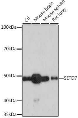 Western Blot: SETD7 Antibody (7Z6I8) [NBP3-16788] - Western blot analysis of extracts of various cell lines, using SETD7 Rabbit mAb (NBP3-16788) at 1:1000 dilution. Secondary antibody: HRP Goat Anti-Rabbit IgG (H+L) at 1:10000 dilution. Lysates/proteins: 25ug per lane. Blocking buffer: 3% nonfat dry milk in TBST. Detection: ECL Enhanced Kit. Exposure time: 3min.