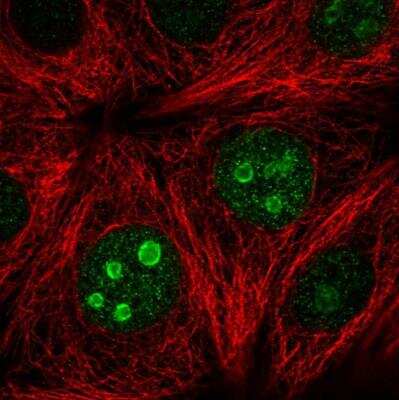 Immunocytochemistry/Immunofluorescence: SETD7 Antibody [NBP2-34101] - Staining of human cell line MCF7 shows localization to nucleoli. Antibody staining is shown in green.