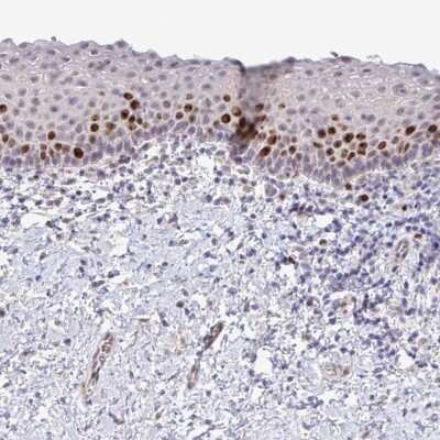 Immunohistochemistry-Paraffin: SETD7 Antibody [NBP2-34101] - Staining of human vagina shows strong nuclear positivity in squamous epithelial cells.