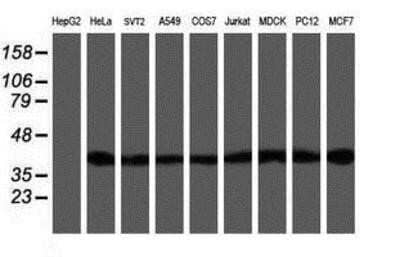 Western Blot: SETD7 Antibody (OTI2D10) - Azide and BSA Free [NBP2-74145] - Analysis of extracts (35ug) from 9 different cell lines by using anti-SETD7 monoclonal antibody.