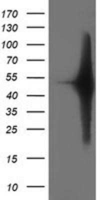 Western Blot: SETD7 Antibody (OTI2D10) - Azide and BSA Free [NBP2-74145] - HEK293T cells were transfected with the pCMV6-ENTRY control (Left lane) or pCMV6-ENTRY SETD7 (Right lane) cDNA for 48 hrs and lysed. Equivalent amounts of cell lysates (5 ug per lane) were separated by SDS-PAGE and immunoblotted with anti-SETD7.