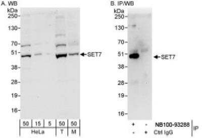 Western Blot: SETD7 Antibody [NB100-93288] - Whole cell lysate from HeLa (5, 15 and 50 mcg for WB; 1 mg for IP, 20% of IP loaded), 293T (T; 50 mcg), and mouse NIH3T3 (M; 50 mcg) cells.  NB100-93288 used for WB at 0.04 mcg/ml (A) and 1 mcg/ml (B) and used for IP at 3 mcg/mg lysate.