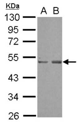 Western Blot: SETD7 Antibody [NBP2-20319] - Sample (30 ug of whole cell lysate) A: A549 B: HeLa 10% SDS PAGE gel, diluted at 1:1000.