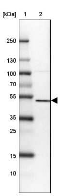 Western Blot: SETD7 Antibody [NBP2-34101] - Lane 1: Marker [kDa] 250, 130, 100, 70, 55, 35, 25, 15, 10Lane 2: U-87 MG