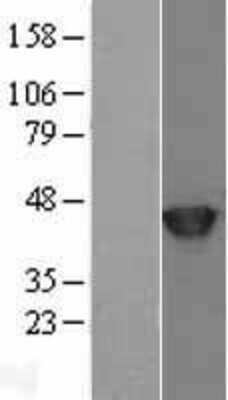 Western Blot: SETD7 Overexpression Lysate (Adult Normal) [NBL1-15869] Left-Empty vector transfected control cell lysate (HEK293 cell lysate); Right -Over-expression Lysate for SETD7.