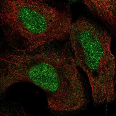 Immunocytochemistry/Immunofluorescence: SETD8 Antibody [NBP2-55772] - Staining of human cell line U-2 OS shows localization to nucleus.