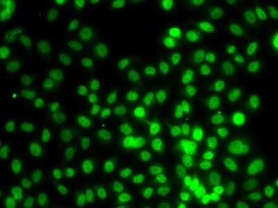 Immunocytochemistry/Immunofluorescence: SETD8 Antibody [NBP2-93042] - Analysis of MCF-7 cells using SETD8 .