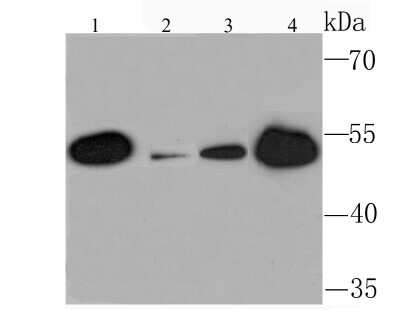 Western Blot: SETD8 Antibody (JM73-43) [NBP2-75662] - Analysis of KMT5A on different lysates using anti-KMT5A antibody at 1/1,000 dilution.Positive control:Lane 1: Mouse kidney       Lane 2: Mouse liverLane 3: 293T               Lane 4: 293