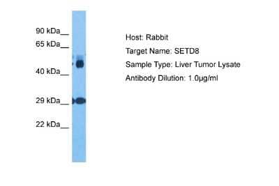 Western Blot: SETD8 Antibody [NBP2-88246] - Host: Rabbit. Target Name: SETD8. Sample Tissue: Human Liver Tumor. Antibody Dilution: 1.0ug/ml