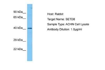 Western Blot: SETD8 Antibody [NBP2-88247] - Host: Rabbit. Target Name: SETD8. Sample Tissue: Human ACHN Whole Cell lysates. Antibody Dilution: 1ug/ml