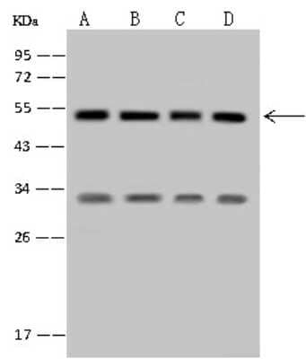 Western Blot: SETD8 Antibody [NBP2-99864] - Anti-SETD8 rabbit polyclonal antibody at 1:500 dilution. Lane A: 293T Whole Cell Lysate. Lane B: HCT-116 Whole Cell Lysate. Lane C: U87-MG Whole Cell Lysate. Lane D: K562 Whole Cell Lysate. Lysates/proteins at 30 ug per lane. Secondary Goat Anti-Rabbit IgG (H+L)/HRP at 1/10000 dilution. Developed using the ECL technique. Performed under reducing conditions. Predicted band size: 42 kDa. Observed band size: 50 kDa