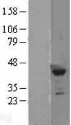 Western Blot SETD8 Overexpression Lysate