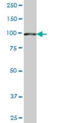 Western Blot: SETDB2 Antibody (1E2) [H00083852-M07] - Analysis of SETDB2 expression in MES-SA/Dx5 (Cat # L021V1).