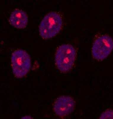 Immunocytochemistry/ Immunofluorescence SETDB2 Antibody