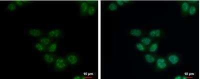 Immunocytochemistry/Immunofluorescence: SETDB2 Antibody [NBP2-20323] - HCT116 cells were fixed in 4% paraformaldehyde at RT for 15 min. Green: SETDB2 protein stained by SETDB2 antibody [N1N2], N-term diluted at 1:500. Blue: Hoechst 33342 staining. Scale bar = 10 um.