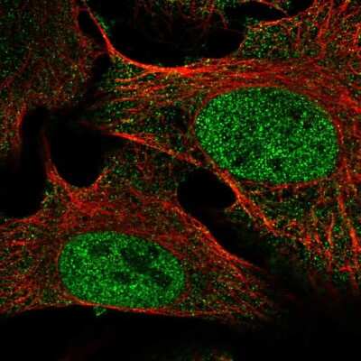 Immunocytochemistry/Immunofluorescence: SETDB2 Antibody [NBP2-57394] - Staining of human cell line U-2 OS shows localization to nucleoplasm & cytosol.